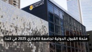 منحة القبول الدولية لجامعة كالجاري 2025 في كندا